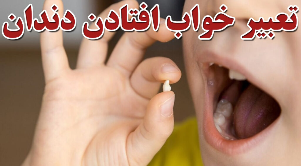 تعبیر خواب افتادن دندان